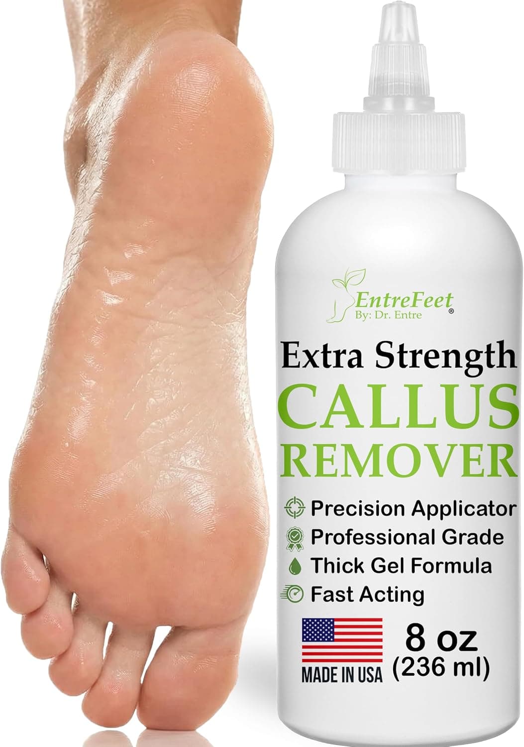 Callus Remover Gel